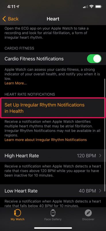 如何设置Apple Watch通知高心率