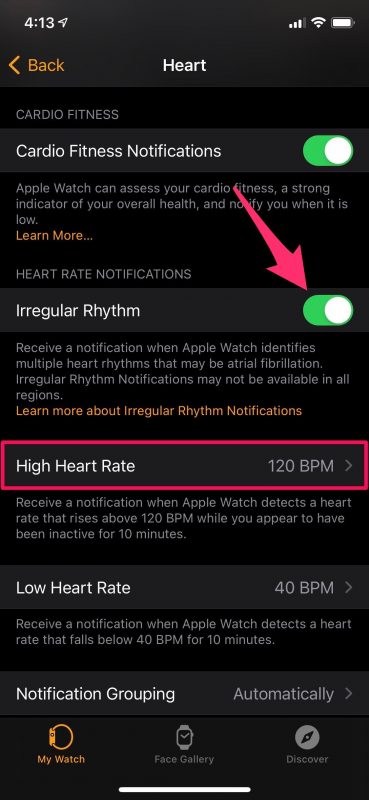 如何设置Apple Watch通知高心率
