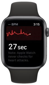 苹果手表心电图应用怎么用，Apple Watch上记录心电图方法